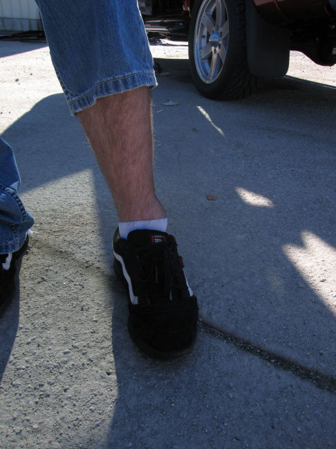Another view of Mike's ankle